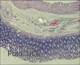 Prevención del daño histológico de un hígado de rata con colitis experimental por glutamina.