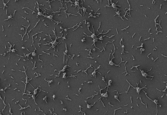 Células de Mycoplasma pneumoniae