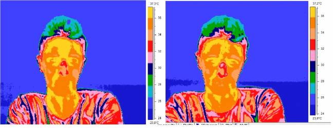  Imágenes obtenidas con el termógrafo