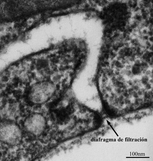 Diafragma de filtración de Drosophila