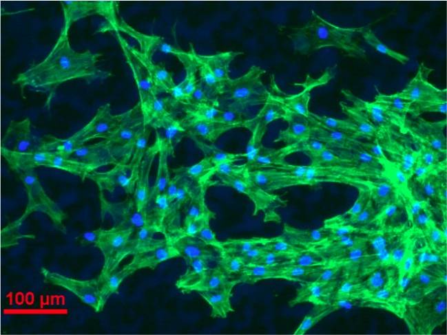 Investigadores de la Universidad Técnica de Oriente Medio (Turquía) y de la Universidad de Valladolid han publicado el trabajo en la revista ‘Biomaterials Science’