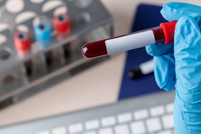 test en sangre, cáncer de páncreas