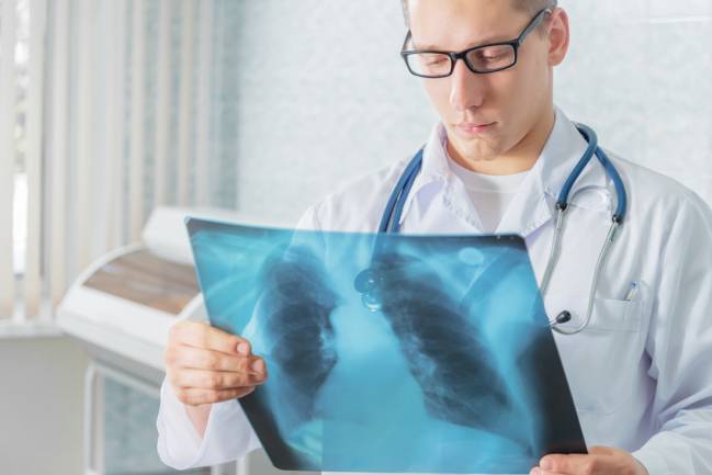 Médico observa una radiografía de un paciente de tuberculosis. / Fotolia