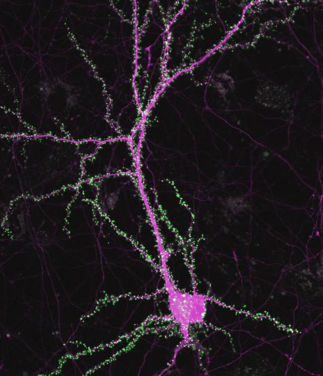 Estas proteínas son esenciales en el desarrollo neuronal