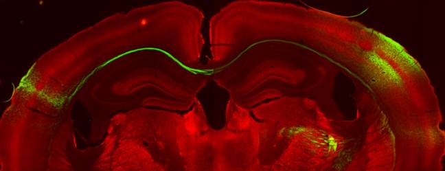 neuronas, hemisferios cerebrales