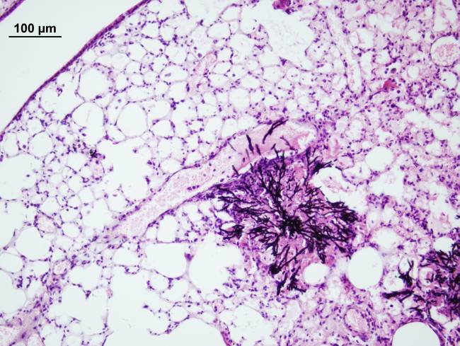 'Aspergillus fumigatus'