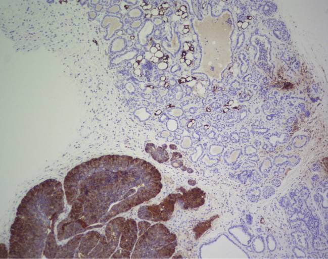 Imagen de inmunohistoquímica de FASN. / CNIO