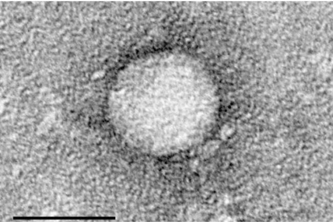 imagen tomada por un microscopio