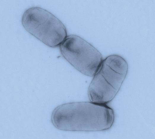 Salmonella enterica es uno de los principales patógenos entéricos tanto en países desarrollados como en regiones en vías de desarrollo.