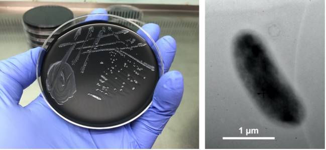 Legionella maioricenseis 