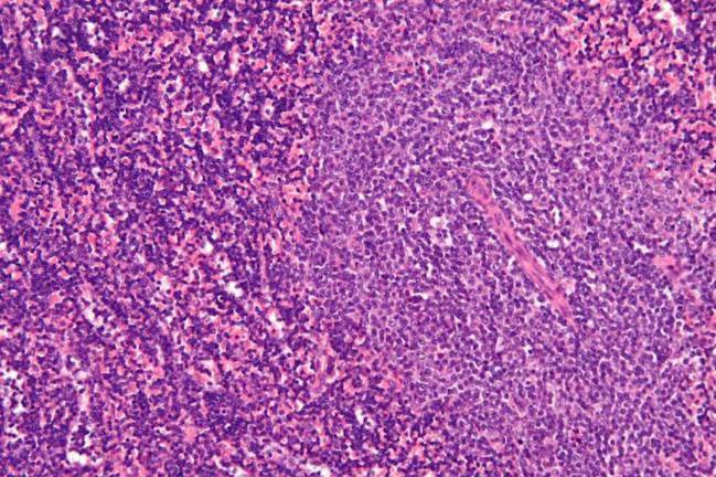 Micrografía de un nodo linfático