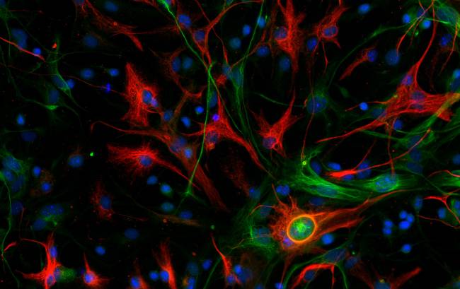 Glioblastoma mesenquimal de ratón