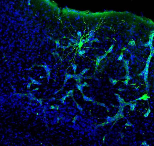 Metástasis en el cerebro de un ratón