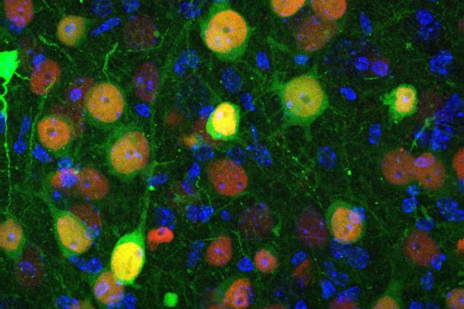 Imagen de microscopía confocal que muestra células de la amígdala basolateral. Fuente: Instituto de Neurociencias. / CSIC / UMH
