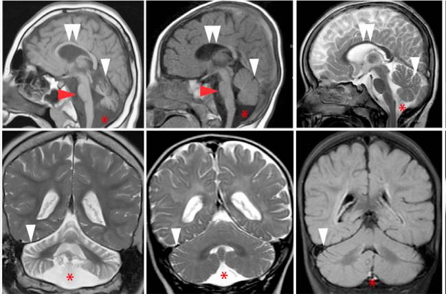 Conexiones neuronales del cerebro humano. / Connectome 