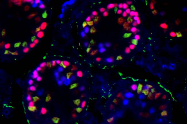 Imagen tomada en el microscopio de fluorescencia en la que aparecen túbulos seminíferos de un testículo mutante en el momento de ocurrir la transdiferenciación sexual. Las células rojas aun son testiculares, y las verdes ya se han transformado en células ováricas. / UGR