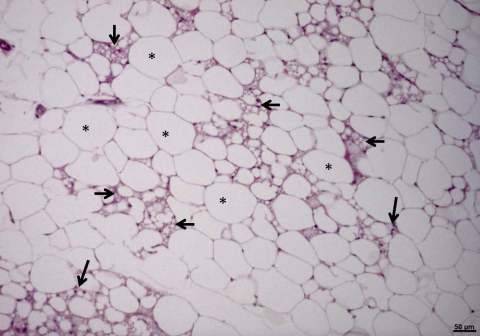 Imagen de un corte histológico de tejido de grasa blanco de rata.