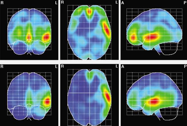 Actividad cerebral en mujeres (arriba) y hombres (abajo) durante el experimento