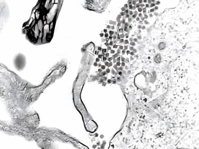 Partículas virales del dengue