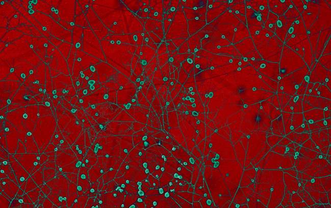 Hongos micorrízicos vistos al microscopio