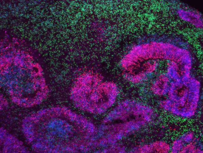 Organoide cortical humano