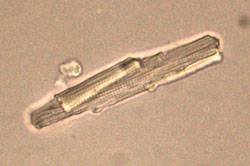 Célula auricular humana