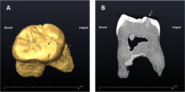 Dientes neandertal