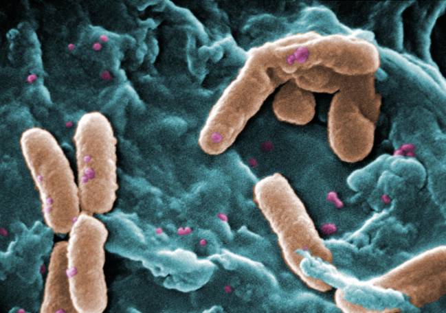 La infección por VIH perturba el ecosistema del intestino. En la imagen, pseudomonas. / Wikipedia