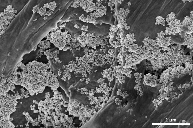 Imagen captada por microscopía electrónica de barrido donde se ve las nanoflores de óxido de hierro sobre microplásticos