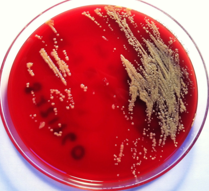 Hasta ahora la bacteria había sido exclusivamente aislada del suelo