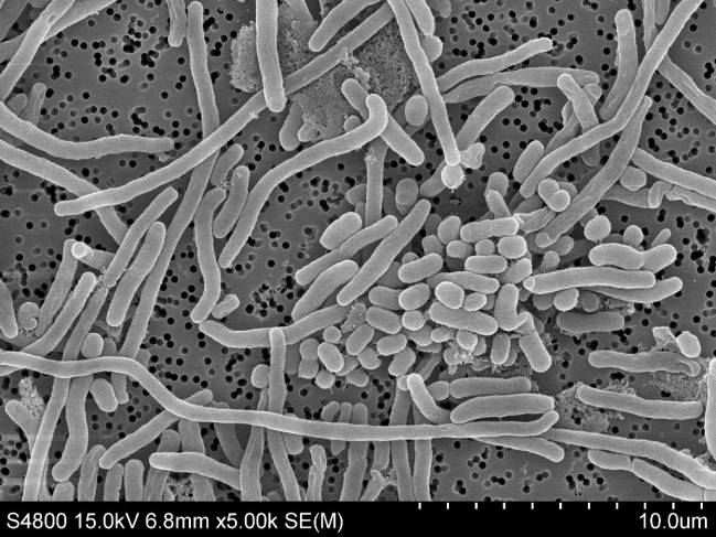 Imagen microscópica de la bacteria Acinetobacter baumannii.