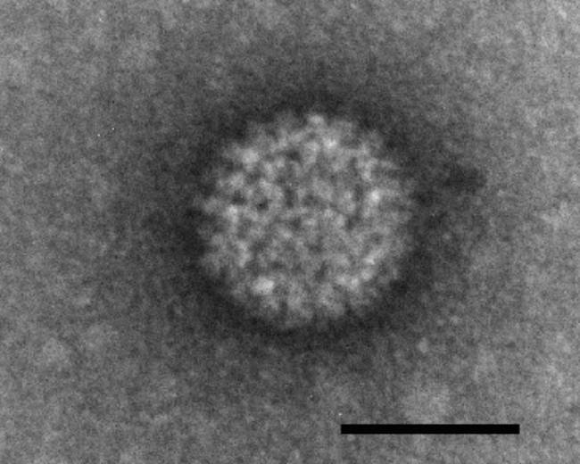 Partícula del virus de la lengua azul. /Wikipedia.