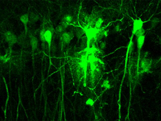 Neuronas hipocampales 