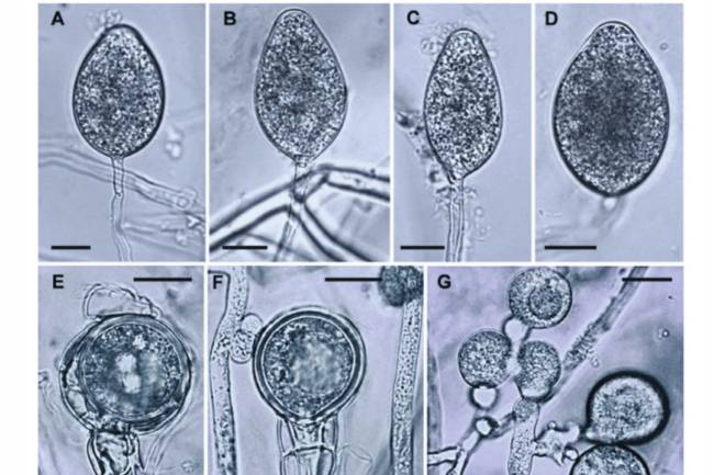 Aspecto morfológico del patógeno exótico Phytophthora cinnamomi al microscopio.