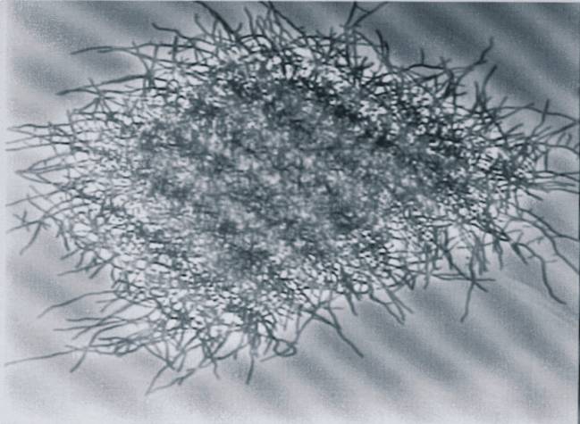 Streptomyces clavuligerus