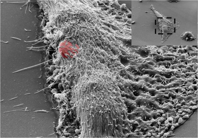 Fotografía SEM de una célula HeLa donde se observa el proceso de introducción de un chip/ Instalación Científico Tecnológica Singular, CNM-IMB.