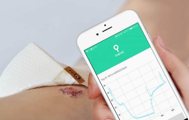 Los datos de la herida recogidos por el parche de grafeno se envían al hospital a través del móvil