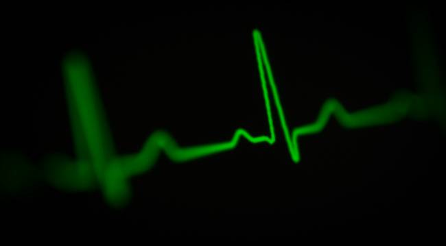 Electrocardiograma en verde
