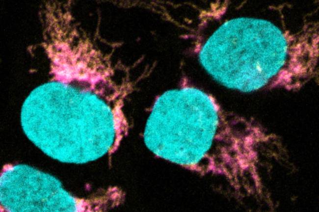 La microscopía confocal muestra la colocalización de EXD2 (magenta) con el ribosoma mitocondrial (amarillo). El ADN se tiñe para definir el núcleo (cian)