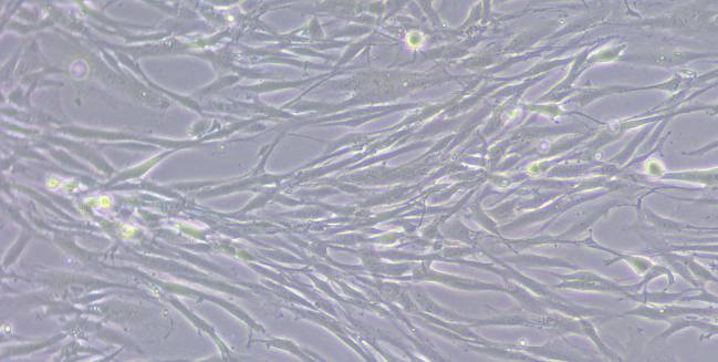 El ‘escudo’ que usa un cáncer de hígado agresivo para resistir la quimioterapia