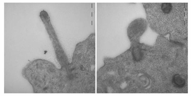 Imágenes de microscopía electrónica