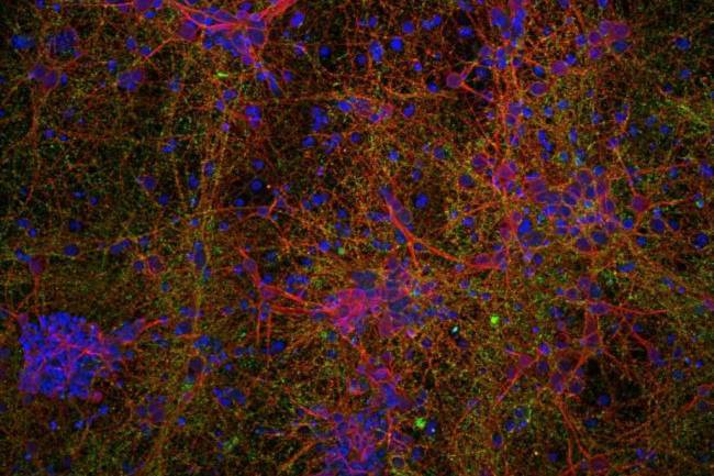 Imagen microscópica de células neurales con nanopartículas de óxido de hierro: neuronas (rojo), sinapsis (verde) y núcleos celulares (azul). / ICMM-CSIC