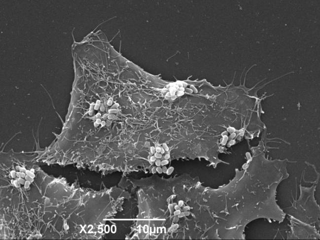E. coli sobre células HeLa