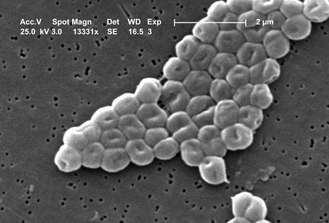 bacteria Acinetobacter_baumannii