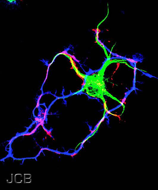 Axón al microscopio. Imagen: TheJCB