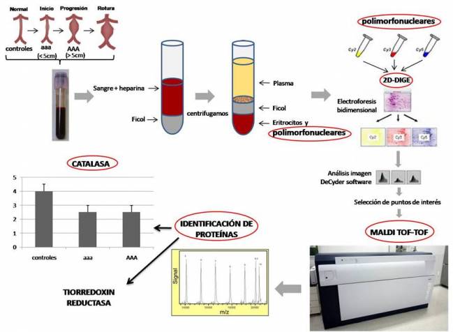 Nuevas evidencias sobre el papel del estrés oxidativo en la progresión del aneurisma de aorta abdominal