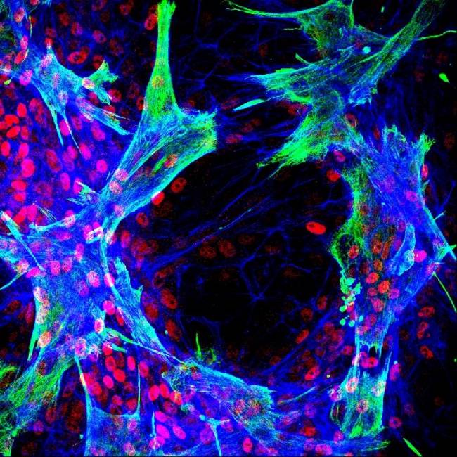 células estrelladas hepáticas primarias humanas