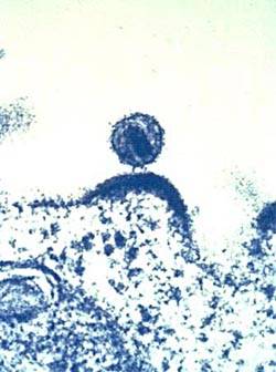 Virus VIH