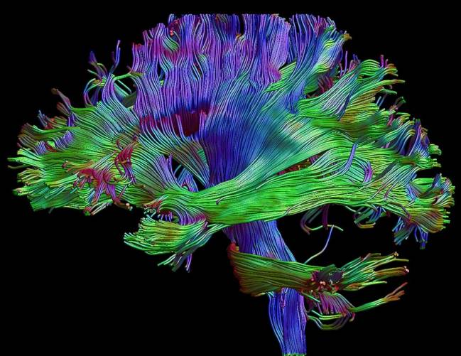 imagen de cerebro generada a partir de resonancia magnética