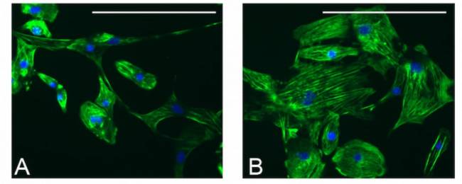 Imagen de Inmunocitoquímica de cardiomiocitos